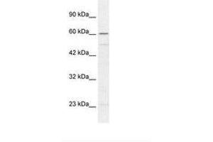Image no. 1 for anti-Zinc Finger Protein 212 (ZNF212) (AA 141-190) antibody (ABIN6735841)