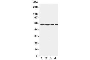 Image no. 2 for anti-Lecithin-Cholesterol Acyltransferase (LCAT) (AA 300-313) antibody (ABIN3031596)