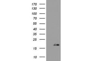 Image no. 1 for anti-Zinc Ribbon Domain Containing 1 (ZNRD1) antibody (ABIN1501853)