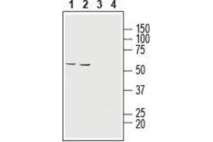 anti-Solute Carrier Family 16, Member 1 (Monocarboxylic Acid Transporter 1) (SLC16A1) (6th Extracellular Loop), (AA 403-415) antibody