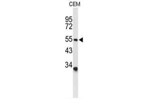 Image no. 3 for anti-Amiloride-Sensitive Cation Channel 2, Neuronal (ACCN2) (AA 499-528), (C-Term) antibody (ABIN950535)