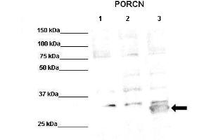 Image no. 1 for anti-Porcupine Homolog (PORCN) (Middle Region) antibody (ABIN2783889)