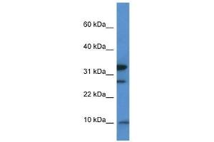 anti-Mitochondrial Ribosomal Protein S33 (MRPS33) (Middle Region) antibody