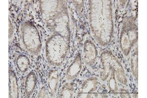 Image no. 2 for anti-Armadillo Repeat Gene Deleted in Velocardiofacial Syndrome (ARVCF) (AA 863-962) antibody (ABIN559961)