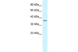 Image no. 1 for anti-SRY (Sex Determining Region Y)-Box 18 (SOX18) (Middle Region) antibody (ABIN2777725)