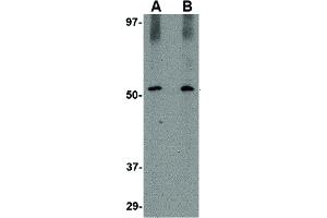 Image no. 3 for anti-Sirtuin 2 (SIRT2) (C-Term) antibody (ABIN6656501)