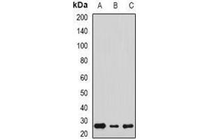 Image no. 2 for anti-sigma Non-Opioid Intracellular Receptor 1 (SIGMAR1) (full length) antibody (ABIN6006092)