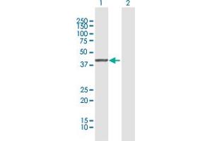 Image no. 3 for anti-serpin Peptidase Inhibitor, Clade B (Ovalbumin), Member 1 (SERPINB1) (AA 1-379) antibody (ABIN515232)