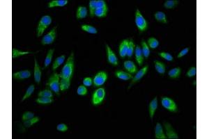 Aspartate beta Hydroxylase antibody  (AA 75-270)