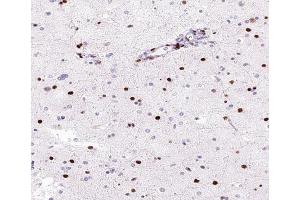 Image no. 3 for anti-Heterogeneous Nuclear Ribonucleoprotein M (HNRNPM) antibody (ABIN6262325)