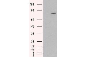 Western Blotting (WB) image for Catenin (Cadherin-Associated Protein), alpha 1, 102kDa (CTNNA1) peptide (ABIN369355)