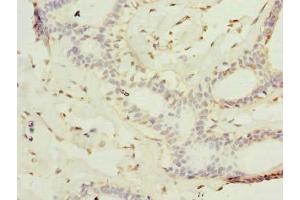 KATNAL2 antibody  (AA 18-307)