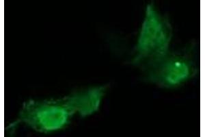 Image no. 3 for anti-HRas proto-oncogene, GTPase (HRAS) antibody (ABIN1498713)