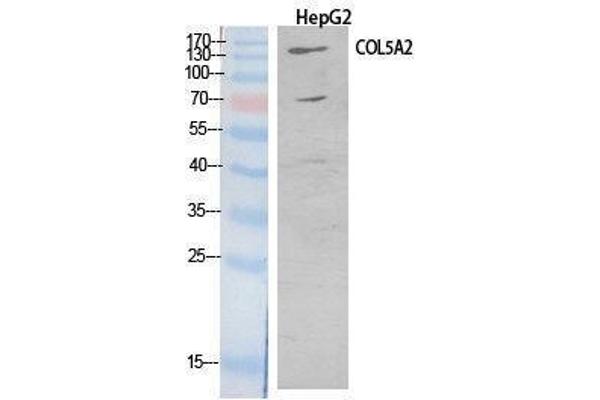 COL5A2 antibody  (Internal Region)