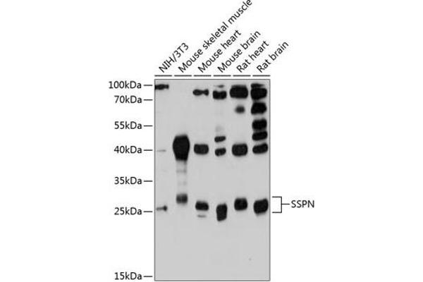 SSPN Antikörper  (AA 1-60)