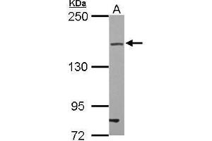 Image no. 1 for anti-Tight Junction Protein 2 (Zona Occludens 2) (TJP2) (Center) antibody (ABIN2855561)