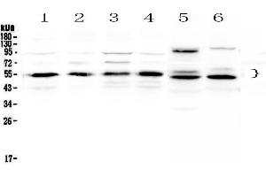 Image no. 1 for anti-Retinoid X Receptor, alpha (RXRA) (AA 226-462) antibody (ABIN5692932)