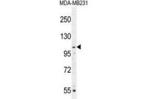 Image no. 3 for anti-Myb-Like, SWIRM and MPN Domains 1 (MYSM1) (AA 118-147), (N-Term) antibody (ABIN953592)
