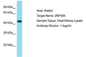 Image no. 1 for anti-Zinc Finger Protein 506 (ZNF506) (AA 322-371) antibody (ABIN6750817)