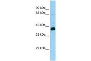 Image no. 1 for anti-Snurportin 1 (SNUPN) (AA 24-73) antibody (ABIN6748330)