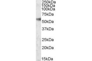 Image no. 1 for anti-SH2 Domain Containing 4A (SH2D4A) (Internal Region) antibody (ABIN334489)