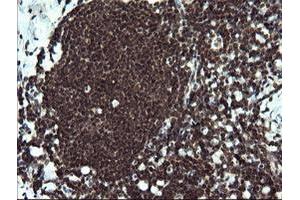 Image no. 2 for anti-V-Ets Erythroblastosis Virus E26 Oncogene Homolog 2 (ETS2) (AA 90-349) antibody (ABIN1491703)