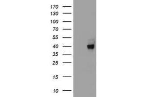 Image no. 2 for anti-alpha-1,4-N-Acetylglucosaminyltransferase (A4GNT) (AA 121-340) antibody (ABIN2715587)
