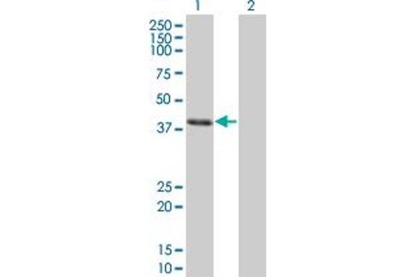 CLN3 antibody  (AA 1-438)