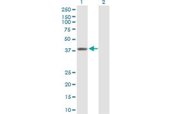 anti-Replication Factor C (Activator 1) 3, 38kDa (RFC3) (AA 1-356) antibody