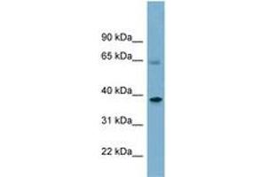 Image no. 1 for anti-Sorting Nexin 7 (SNX7) (AA 359-408) antibody (ABIN6741940)
