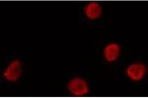 Image no. 1 for anti-Single-Strand-Selective Monofunctional Uracil-DNA Glycosylase 1 (SMUG1) antibody (ABIN6259193)