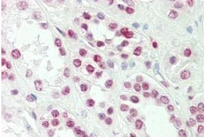 Image no. 1 for anti-T-Cell Leukemia Homeobox 1 (TLX1) (AA 163-191) antibody (ABIN1942238)