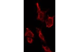 Image no. 2 for anti-SAR1 Homolog B (SAR1B) (Internal Region) antibody (ABIN6259183)