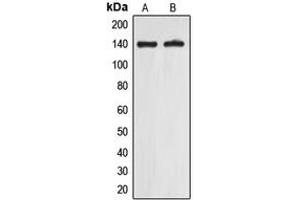 Image no. 2 for anti-Eukaryotic Translation Initiation Factor 5B (EIF5B) (C-Term) antibody (ABIN2704756)