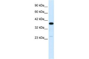 Image no. 2 for anti-Complement Component 4 Binding Protein, beta (C4BPB) (N-Term) antibody (ABIN2778139)