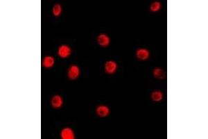 Image no. 1 for anti-Transcription Elongation Factor A (SII)-Like 1 (TCEAL1) antibody (ABIN2801351)