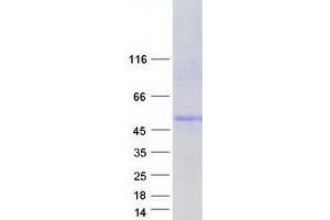 Image no. 1 for Cystinosis, Nephropathic (CTNS) (Transcript Variant 2) protein (Myc-DYKDDDDK Tag) (ABIN2712807)