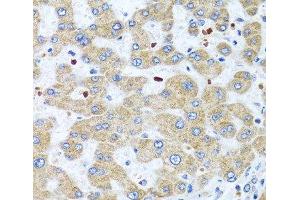 Immunohistochemistry of paraffin-embedded Human liver using NMU Polyclonal Antibody at dilution of 1:100 (40x lens).