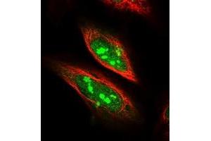 SDAD1 antibody
