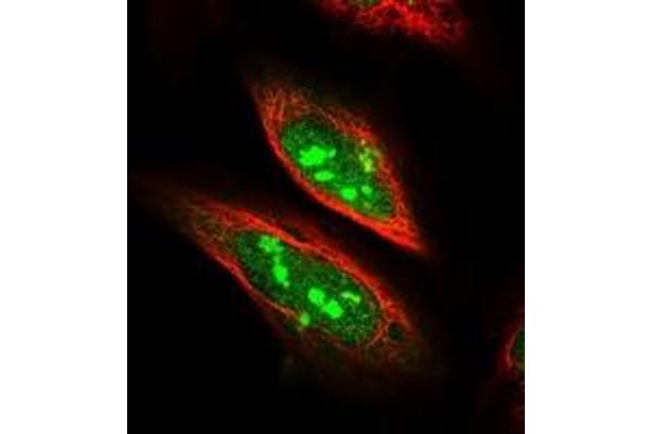 SDAD1 antibody