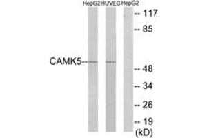 CAMKV Antikörper  (AA 211-260)