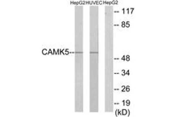 CAMKV Antikörper  (AA 211-260)