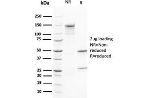 Calretinin antibody  (AA 23-242)