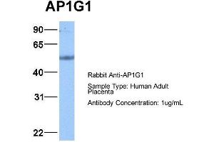 Image no. 2 for anti-Adaptor-Related Protein Complex 1, gamma 1 Subunit (AP1G1) (C-Term) antibody (ABIN2784689)