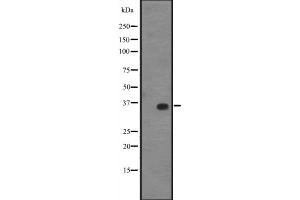 Image no. 1 for anti-Kruppel-Like Factor 14 (KLF14) (C-Term) antibody (ABIN6258901)
