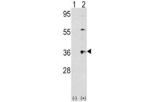 Image no. 1 for anti-Thrombopoietin (THPO) (AA 243-273) antibody (ABIN3029127)