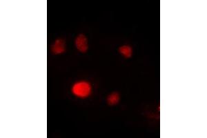Image no. 1 for anti-Spleen Focus Forming Virus (SFFV) Proviral Integration Oncogene Spi1 (SPI1) (Center) antibody (ABIN2972599)