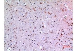 Image no. 2 for anti-Mesencephalic Astrocyte-Derived Neurotrophic Factor (MANF) (Internal Region) antibody (ABIN3187826)