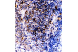 Image no. 1 for anti-Fc Fragment of IgE, Low Affinity II, Receptor For (CD23) (FCER2) (AA 50-331) antibody (ABIN3043829)