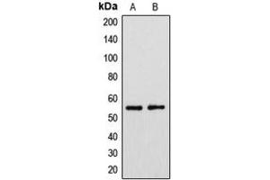 Image no. 2 for anti-Cytochrome P450, Family 39, Subfamily A, Polypeptide 1 (CYP39A1) (C-Term) antibody (ABIN2704700)